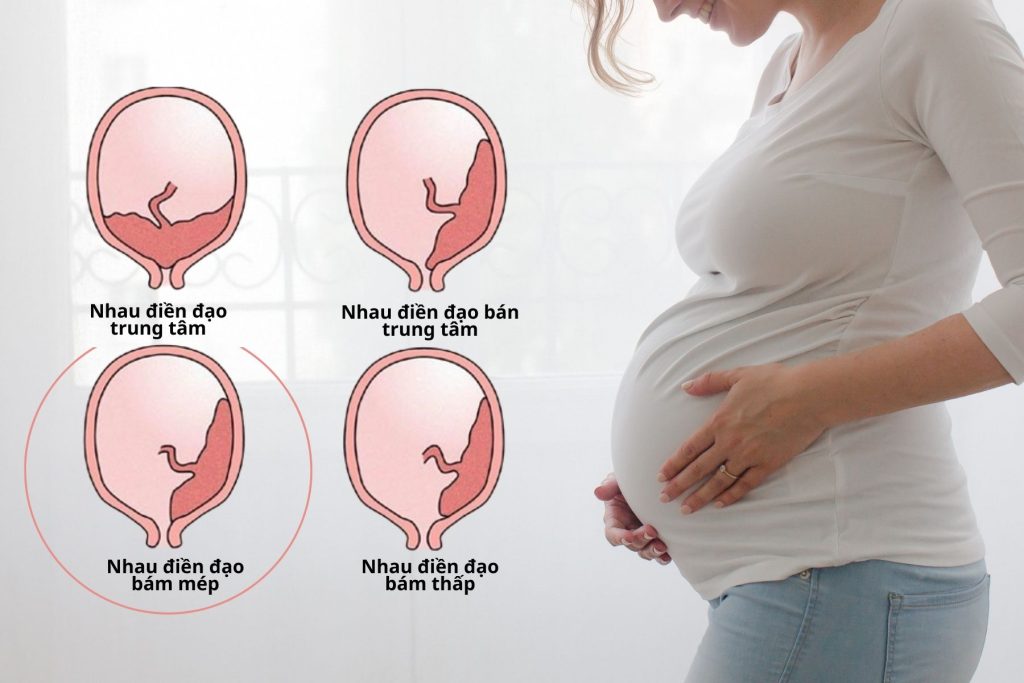 Kết luận về vị trí tiền đạo trung tâm