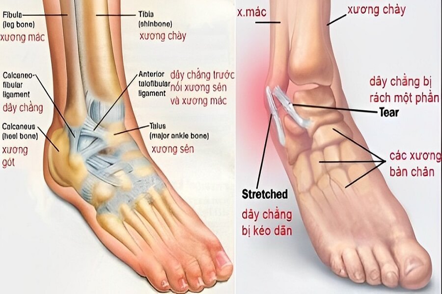Lật Sơ Mi Cổ Chân - Hiểu Một Cách Toàn Diện Nhất về Khái Niệm Lý Thuyết Cho Mọi Đối Tượng